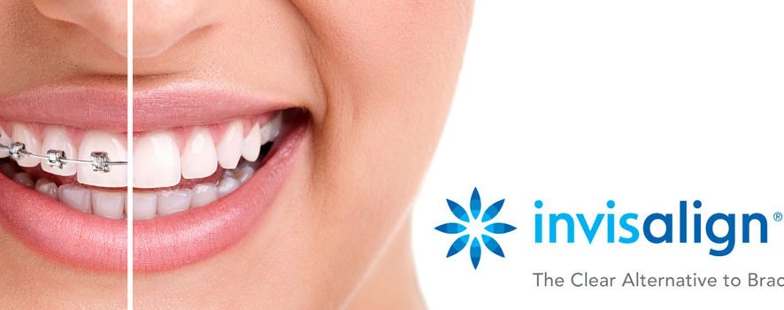 Invisalign is your opportunity for a perfect smile