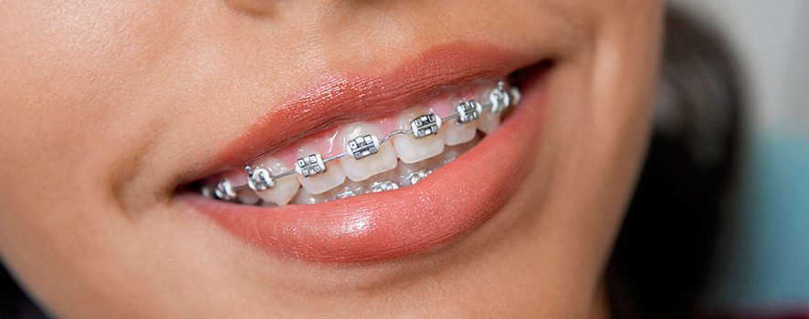 Winnipeg Orthodontists